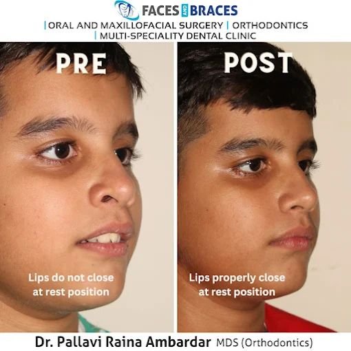 Facial and Dental Correction